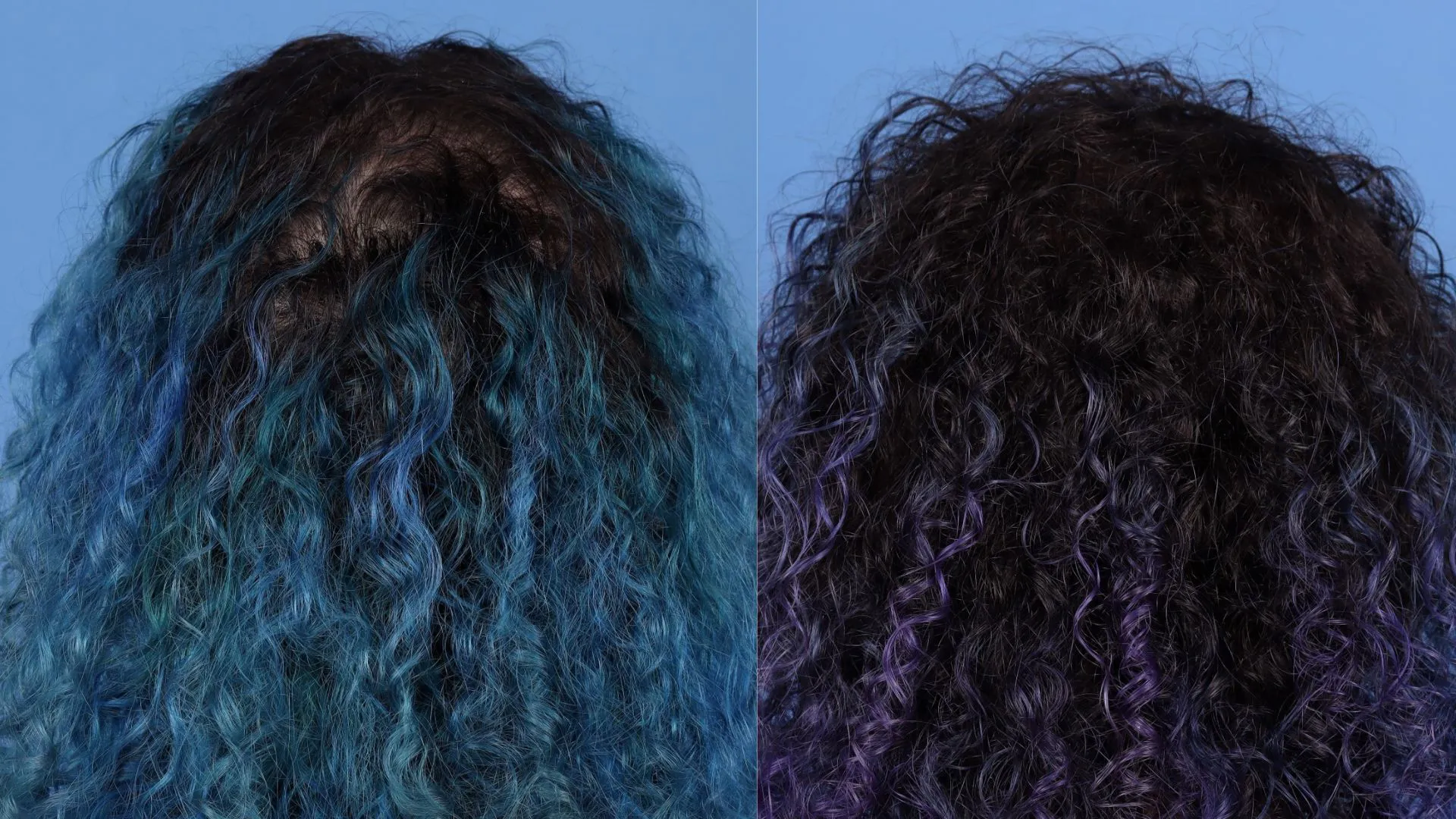 Hair Restoration Before & After | La Bella Medispa